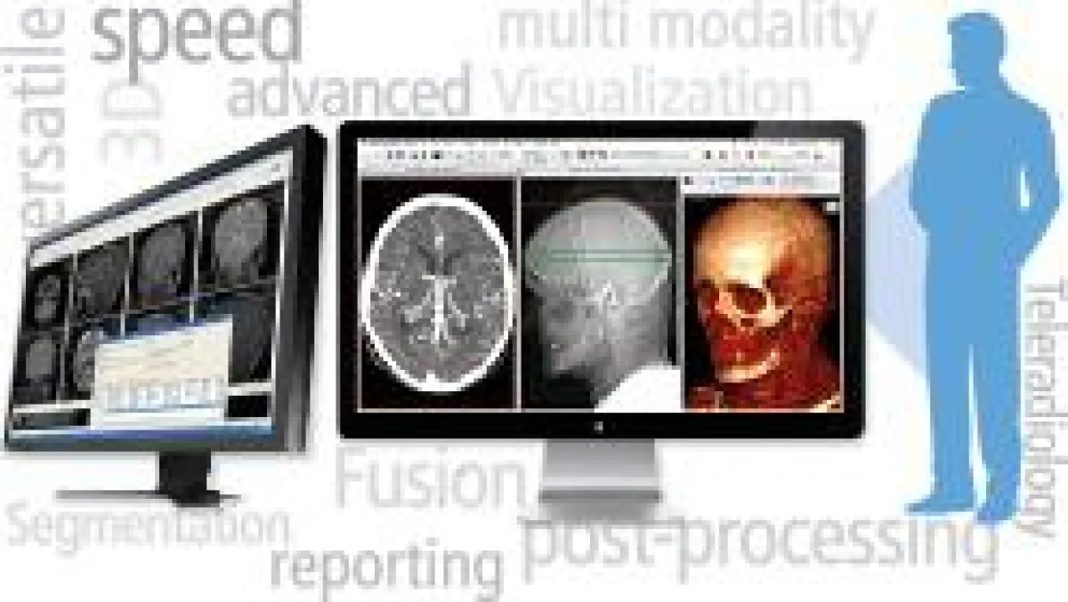 aycan OsiriX PRO - Die vielseitige Befundungs- und Postprocessing Workstation.