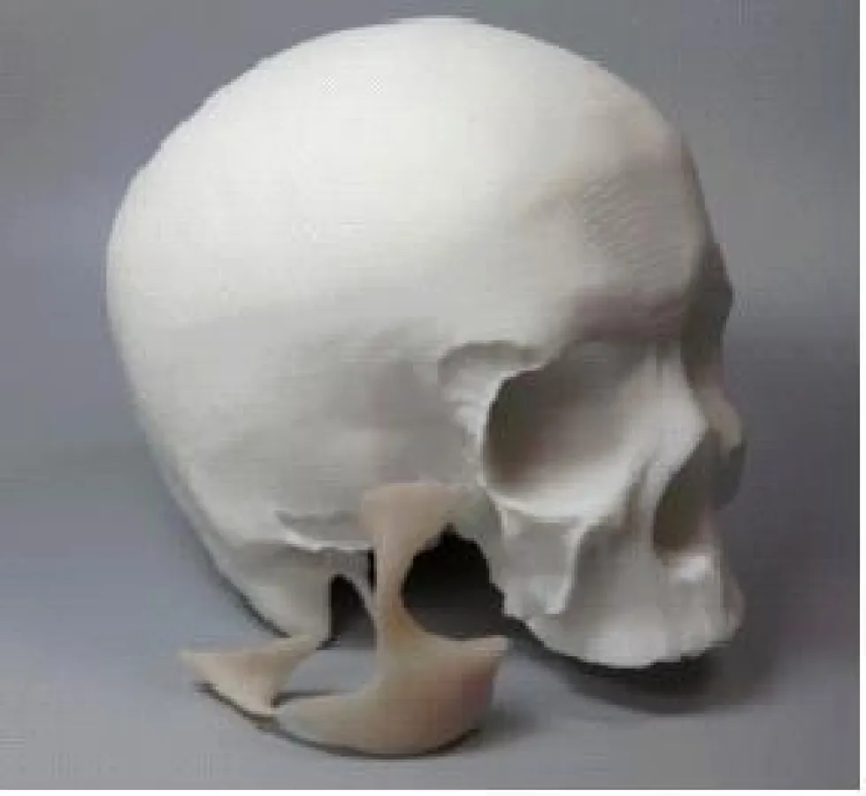 Prototyp eines PP Implantates