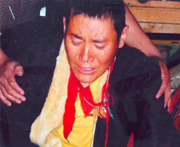 Bild: Tibetische Nonne durch schwere Mißhandlungen hirngeschädigt