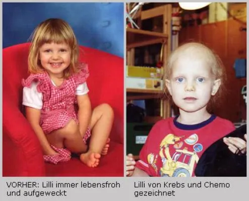 Bild: Fairvital unterstützt schwer krebskrankes kleines Mädchen