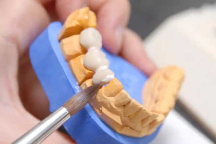 Bild: Beutin Dental seit 20 Jahren in der Zahntechnik aktiv