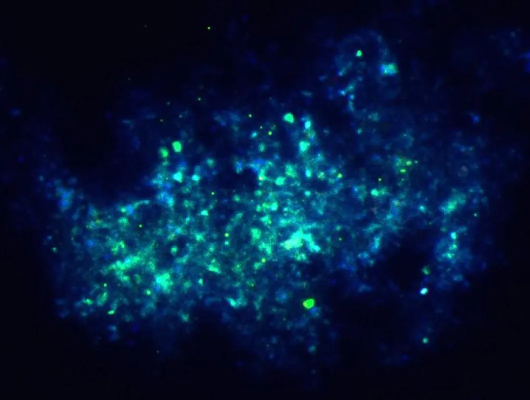 Metallosphaera sedula-Wachstum auf synthetischen Mars-Regolith. Die Mikroben sind spezifisch angefärbt mit Hilfe der Fluoreszenz-in-situ-Hybridisierung (FISH). (Copyright Tetyana Milojevic)