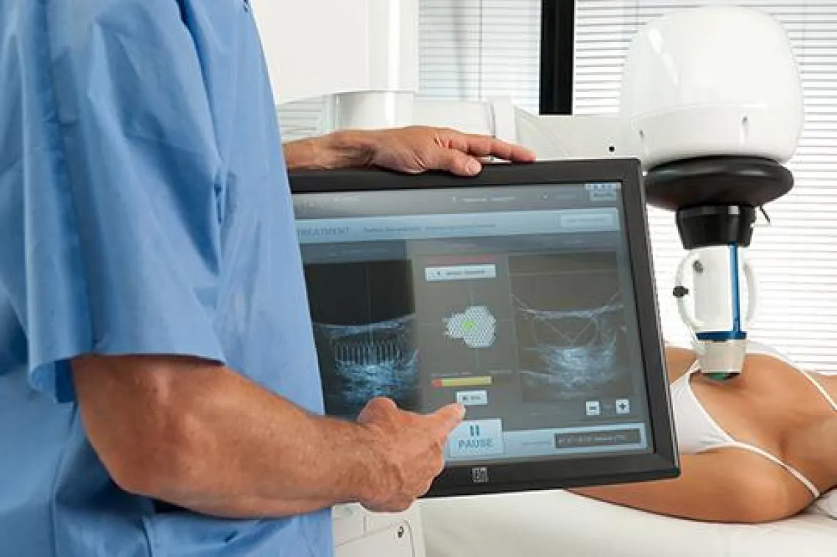 Das EchoPulse System zur schonenden Behandlung von Fibroadenomen