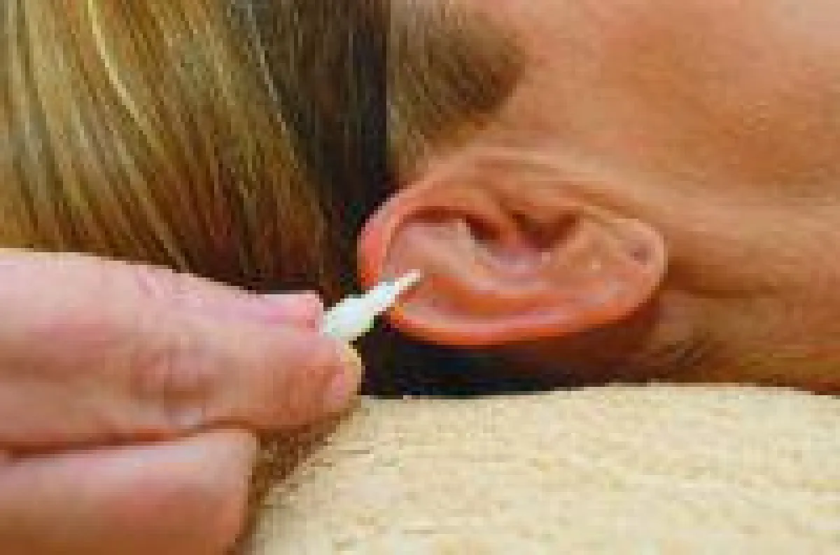 Hilfe bei Parkinson und RLS: Bei der Implantat-Akupunktur setzt Dr. Wlasak winzige Titan-Nadeln ins Ohr