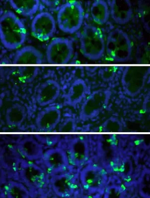 Bild: Übergewichtige haben zu wenig Zellen mit Sättigungshormonen