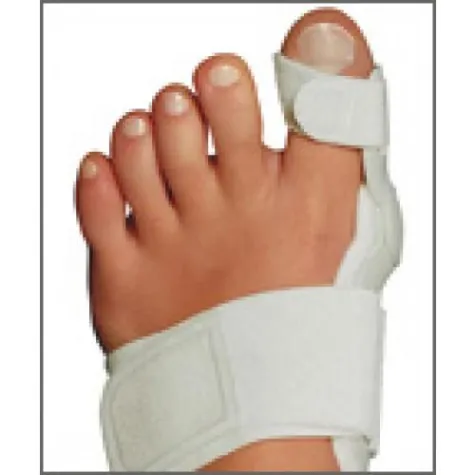 Bild: Diagnose „Hallux valgus“: Behandlungsmöglichkeiten – ohne OP