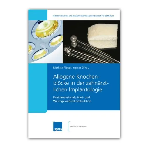 Bild: Allogene Knochenblöcke in der zahnärztlichen Implantologie