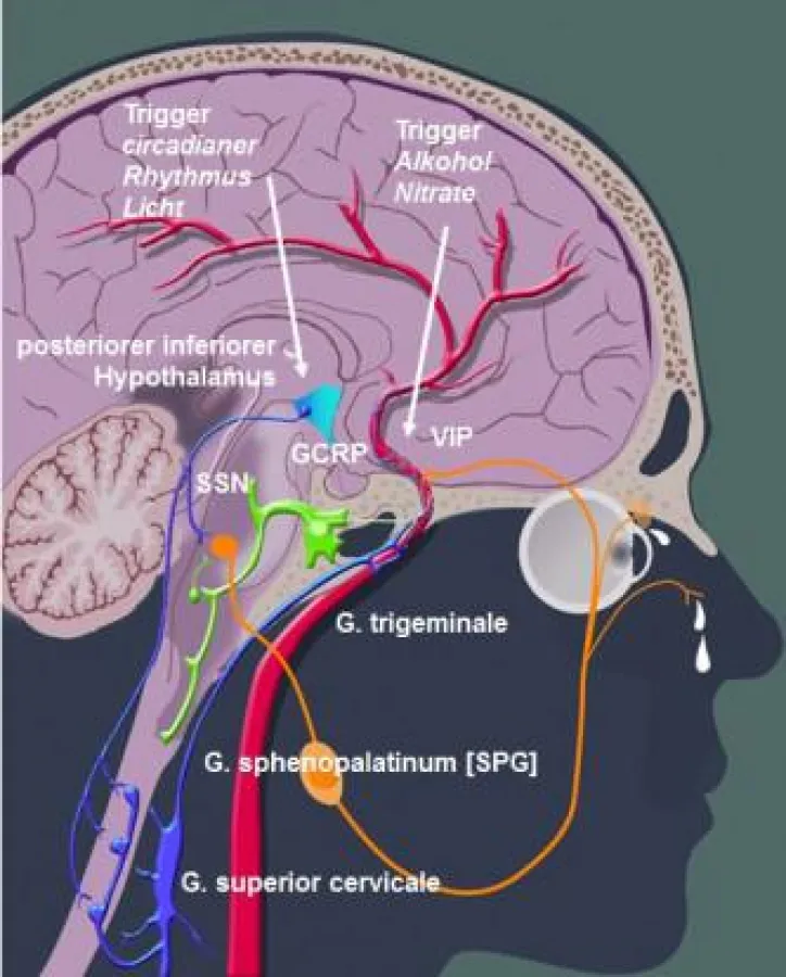 Theorien zur Entstehung von Clusterkopfschmerzen