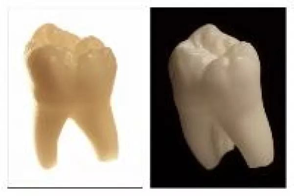 Was definiert die Zahnzusatzversicherung als fehlende Zähne? Bild: Was definiert die Zahnzusatzversicherung als fehlende Zähne?