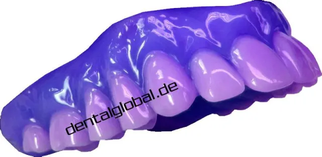 Bild: VDZI vermeldet Rückgang in der Zahntechnik