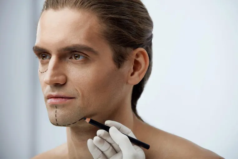 Das Fadenlift als Alternative zu Filler und Facelift Bild: Das Fadenlift als Alternative zu Filler und Facelift