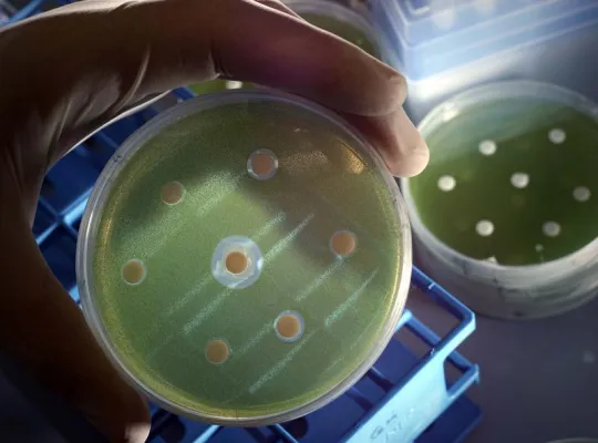 Treibjagd in der Petrischale Bild: Treibjagd in der Petrischale