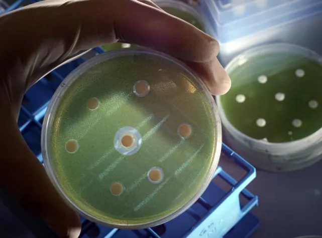 Bild: Treibjagd in der Petrischale