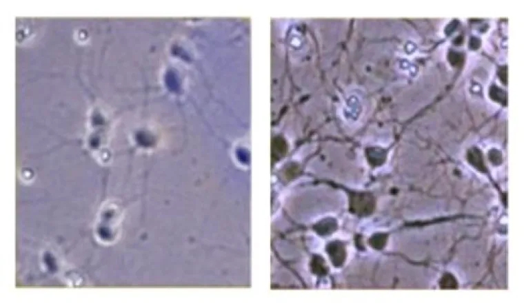 Neu: OMEGA IQ - 50-fach effektiver als herkömmliche Omega-3-Fettsäuren Bild: Neu: OMEGA IQ - 50-fach effektiver als herkömmliche Omega-3-Fettsäuren