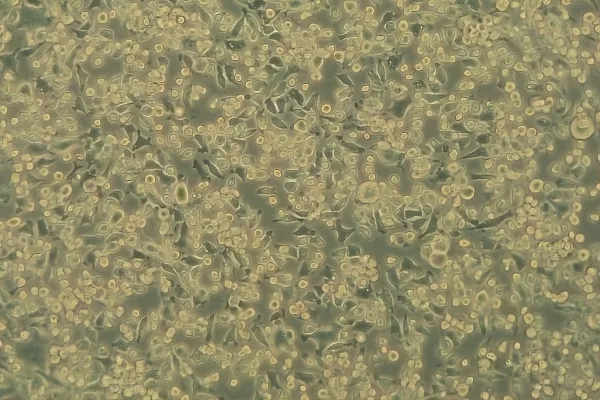 Antivirale Prüfungen an Infektionsschutztextilien Bild: Antivirale Prüfungen an Infektionsschutztextilien