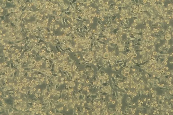 Antivirale Prüfungen an Infektionsschutztextilien Bild: Antivirale Prüfungen an Infektionsschutztextilien