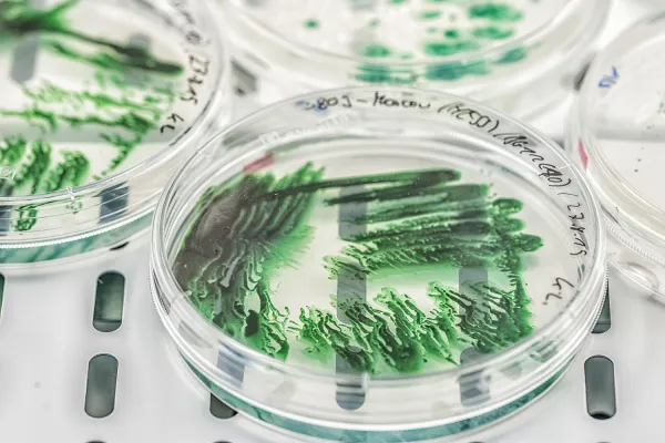 Bild: Nicht nur toxisch, sondern auch Nährstoff: Guanidin als Stickstoffquelle