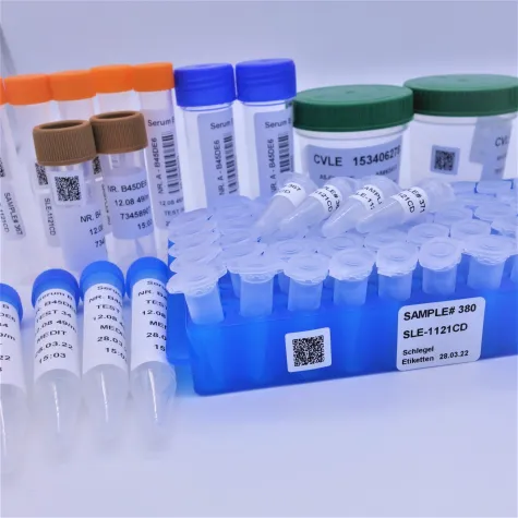 Pharma- & Laboretiketten zur professionellen Probekennzeichnung Bild: Pharma- & Laboretiketten zur professionellen Probekennzeichnung