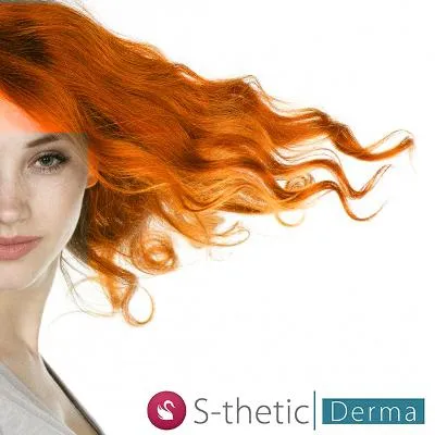 Bild: S-thetic Derma Berlin: „Rothaarige verlieren Haare“