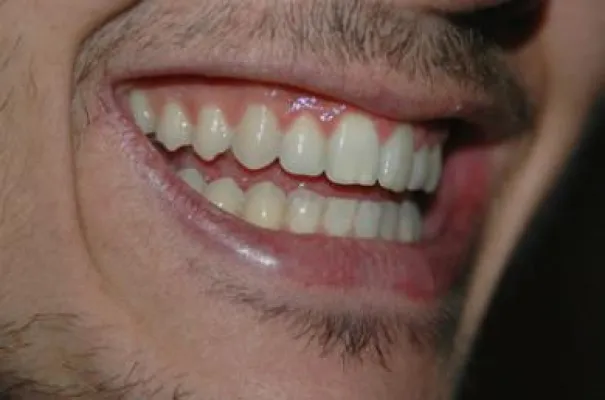 Ist das Zahnfleisch gesund, freut sich der Mensch Bild: Ist das Zahnfleisch gesund, freut sich der Mensch