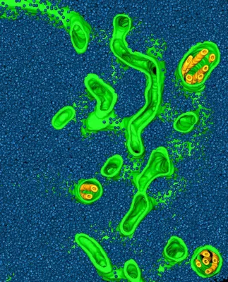 Bild: The pyrenoid is a carbon-fixing liquid droplet