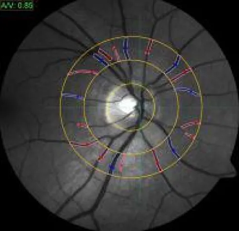 Bild: Eine Vision wird Wirklichkeit