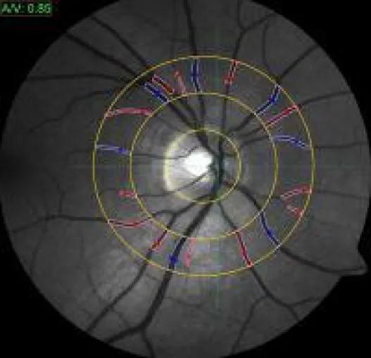 Bild: Eine Vision wird Wirklichkeit
