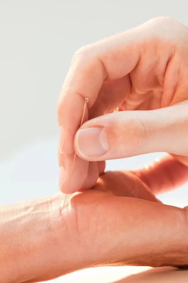 Wissenschaftler des Universitätsklinikums Heidelberg untersuchen, ob Akupunktur gegen Stress hilft. (Universitätsklinikum Heidelberg)