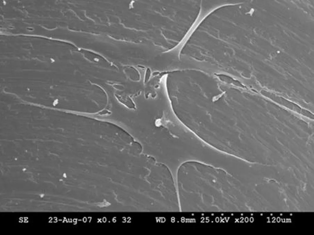 Optimales Wachstum von Gingivafibroblasten auf ZrN