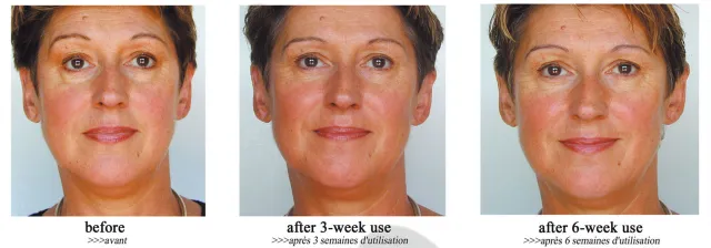 Entspannende Therapie für die Gesichtsmuskulatur Bild: Entspannende Therapie für die Gesichtsmuskulatur