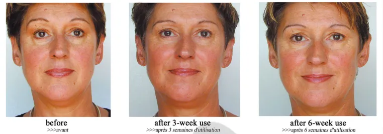 Entspannende Therapie für die Gesichtsmuskulatur Bild: Entspannende Therapie für die Gesichtsmuskulatur