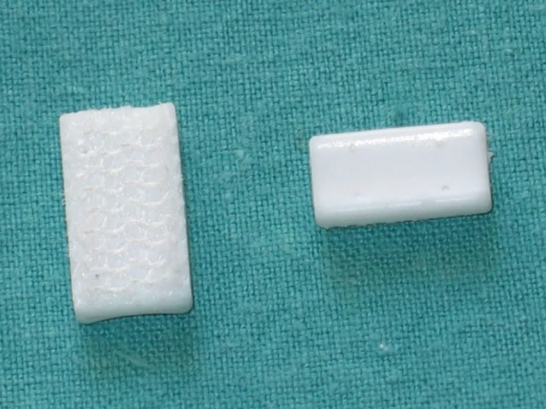 Das neue Implantat Canaletto von Proconcept regeneriert die Funktion der Hand