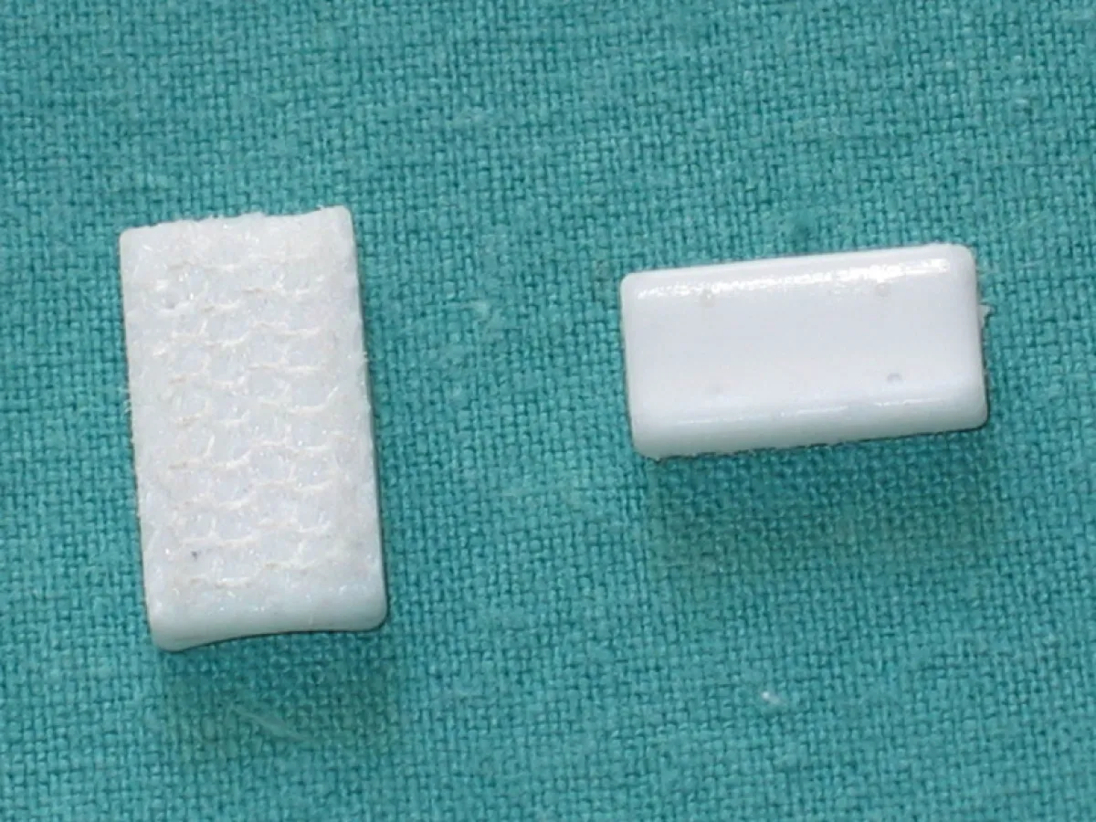 Das neue Implantat Canaletto von Proconcept regeneriert die Funktion der Hand