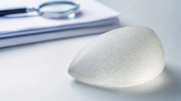 Bild: Neue Erkenntnisse zu Allergan BIOCELL: Deutsches Gericht stellt fehlenden ALCL-Hinweis fest