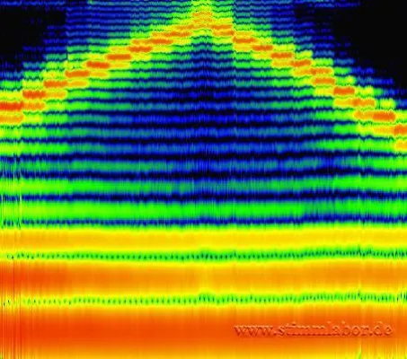 Bild: Stimmanalyse in Berlin, jetzt mit Grafiken vom Frequenzspektrum der Stimme