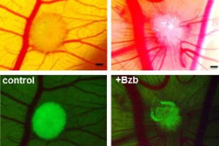 Schalenloses Hühnerei für die Myelom-Forschung Bild: Schalenloses Hühnerei für die Myelom-Forschung