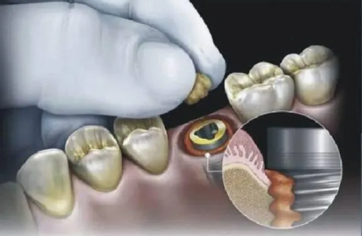 Von der Gewebezüchtung bis zur Rehabilitation Bild: Von der Gewebezüchtung bis zur Rehabilitation