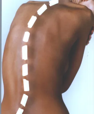 Bild: Übersäuerung erhöht Osteoporose-Risiko