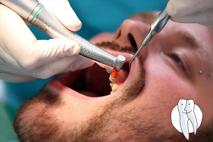 Bild: Zahnreinigung - warum und wie oft?