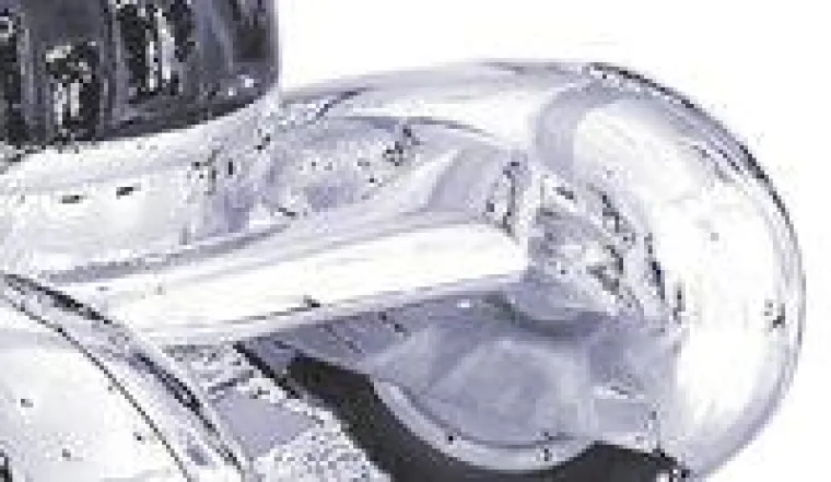 Bei einem Kfz-Schaden besser einen Kfz-Sachverständigen rufen Bild: Bei einem Kfz-Schaden besser einen Kfz-Sachverständigen rufen