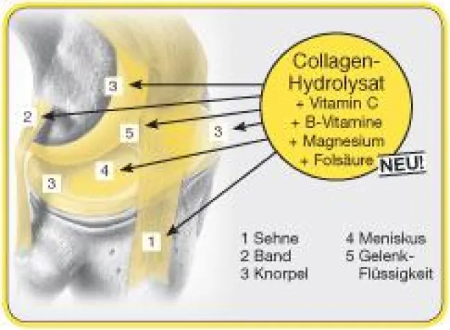 Bild: Winterzeit – Zeit für Gelenkprobleme?