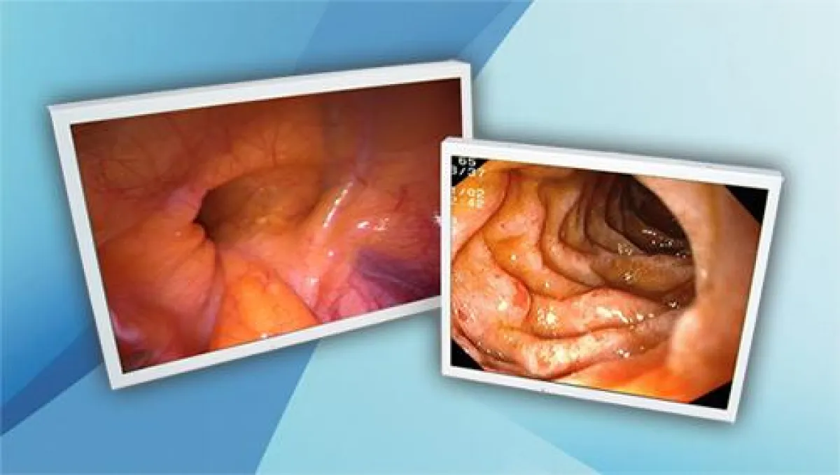 creco Medical Monitore