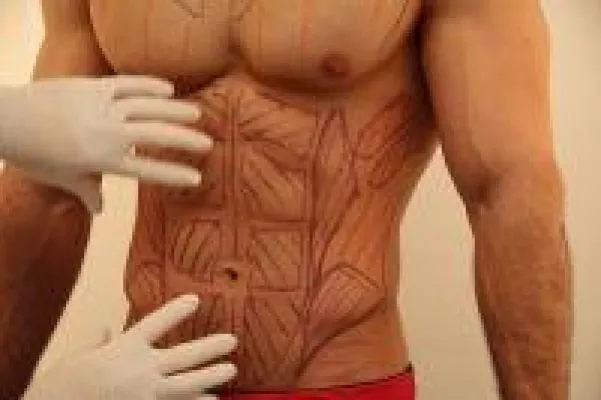 Bild: Fibo 2020 - Sixpack OP vs Sixpack ohne OP - Ein schöner Anblick ?