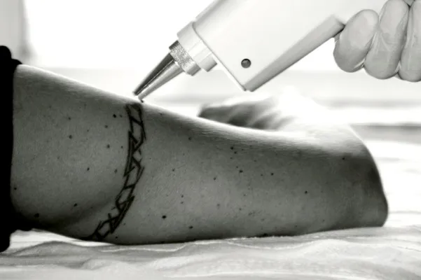 Bild: Wenn das Tattoo zur Last wird