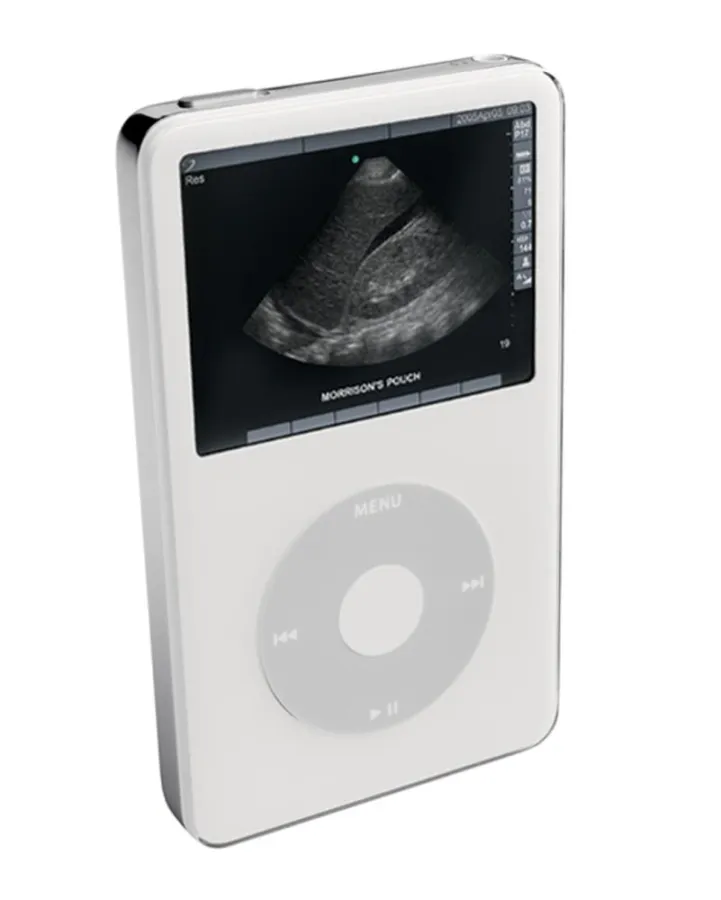 SonoSite-Ultraschallbild des Zwischenraums zwischen Leber und rechter Niere (so genannter Morrison-Pouch), ein wichtiger Bereich für die Untersuchung von stumpfen Traumata, dargestellt auf einem Apple