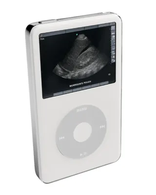 SonoSite bietet Auffrischungskurse für Ärzte auf iPods von Apple Bild: SonoSite bietet Auffrischungskurse für Ärzte auf iPods von Apple