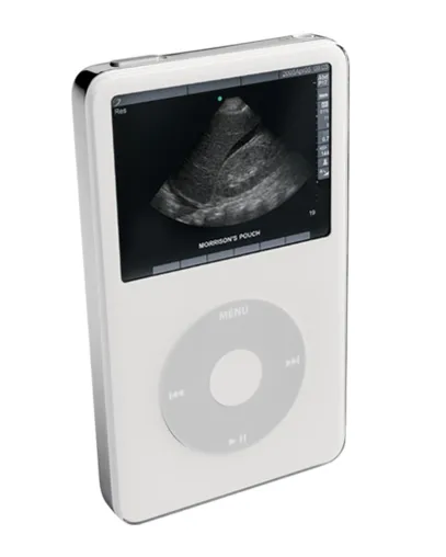Bild: SonoSite bietet Auffrischungskurse für Ärzte auf iPods von Apple