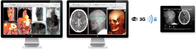 Bild: aycan mit PACS Lösungen auf dem MR-Symposium in Garmisch Partenkirchen 2013