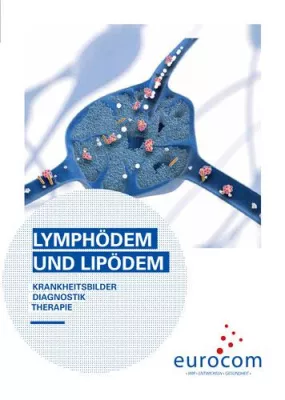 Lymph- und Lipödeme diagnostizieren und behandeln Bild: Lymph- und Lipödeme diagnostizieren und behandeln