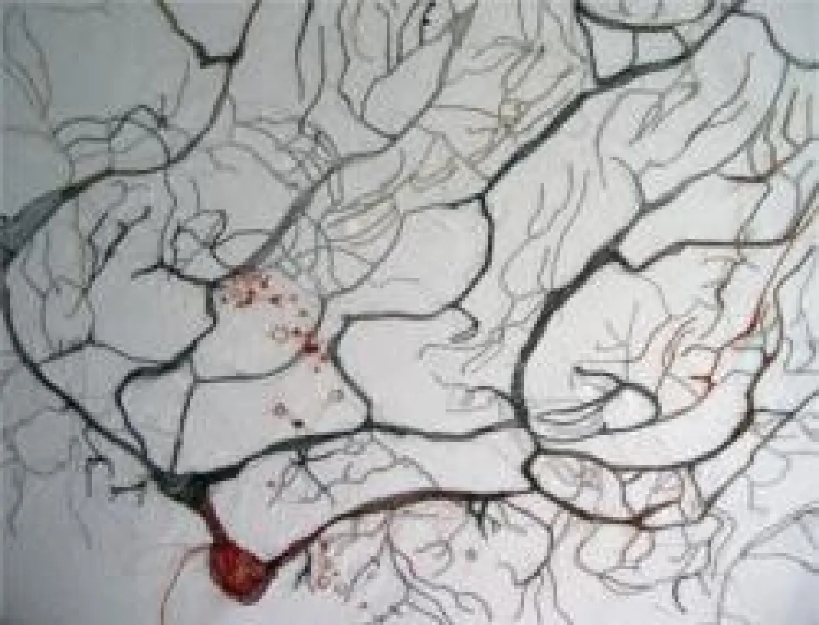 © Laura Sánchez Filomeno, Neurona de mosca, 2008